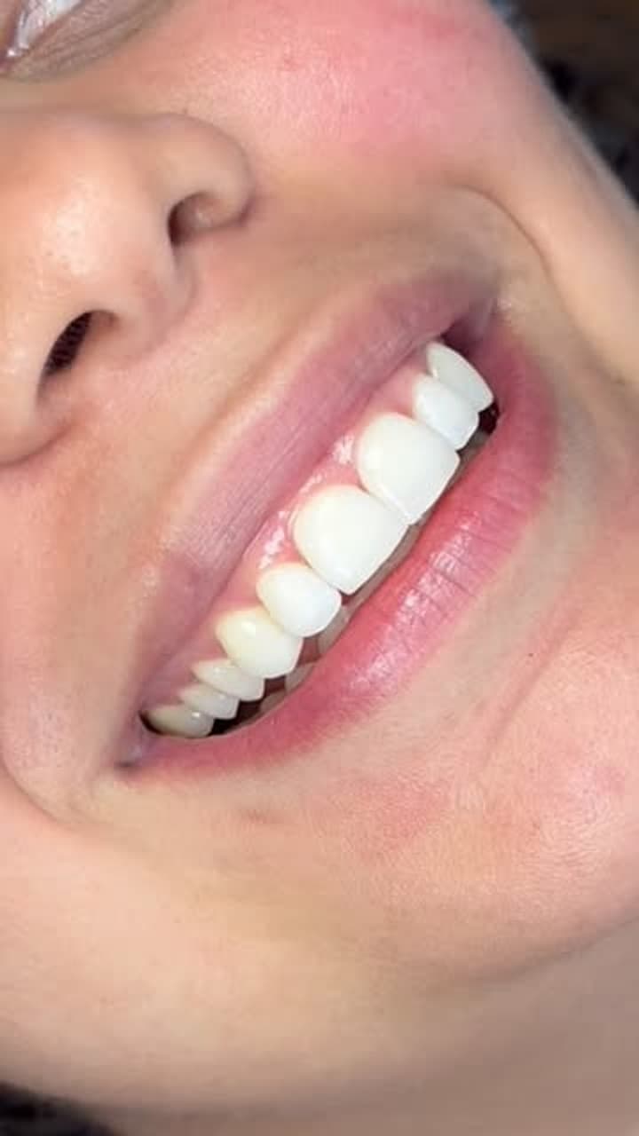Planejamento estético do sorriso